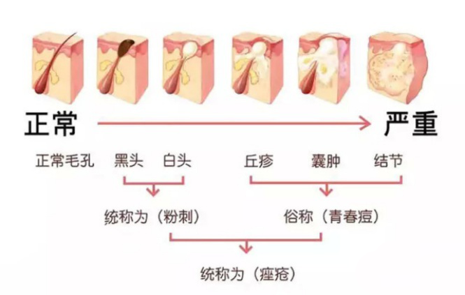 傳明酸精華液 | 解決口罩痘肌色沉